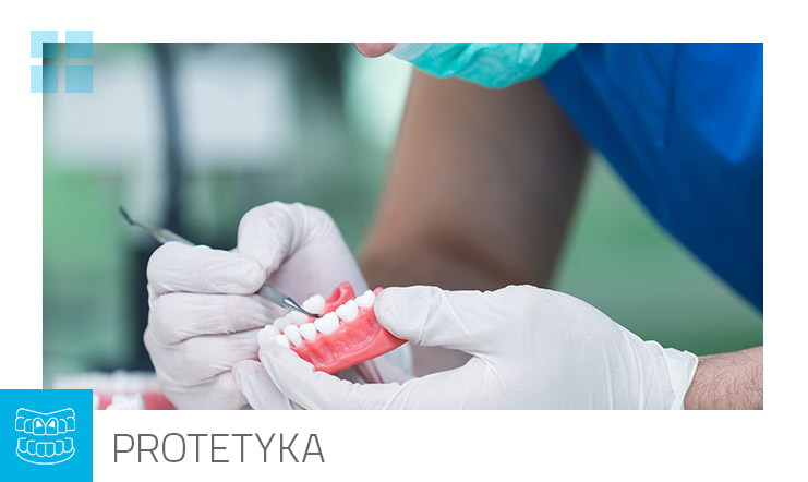 Protetyka
