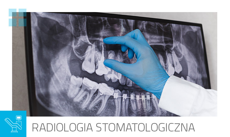 Radiologia-stomatologiczna
