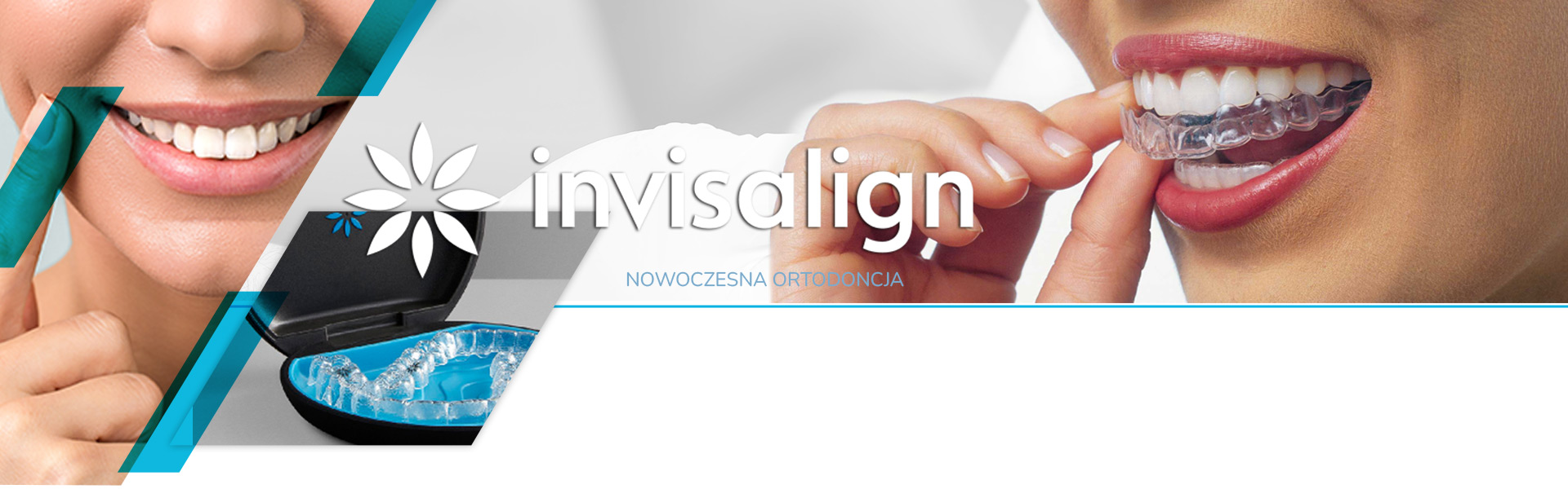 INVISALIGN